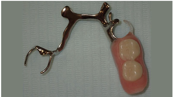 Dental Partial in Glastonbury, CT
