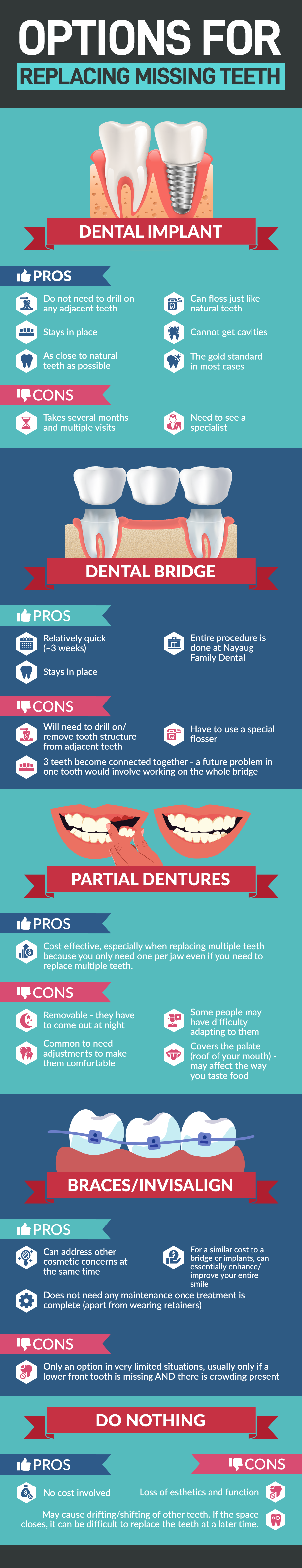 options-for-missing-teeth-infographic